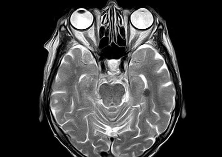 Le porno est dangereux pour le cerveau, à voir avec modération